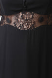 Lace Inset Button Up Day Dress